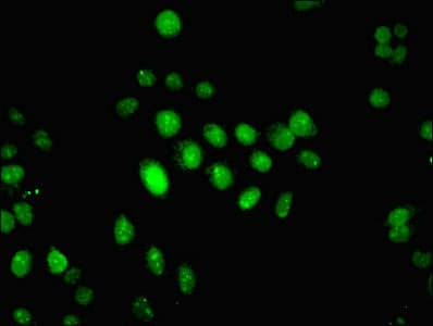 Polyclonal Rabbit anti-Human IFI44 Antibody (IHC, WB)