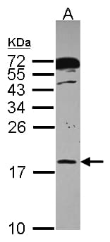 Polyclonal Rabbit anti-Human POLR2H / RPB8 Antibody (aa1-150, WB)