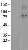 SLC26A2 Protein (Over-Expression Lysate Myc-DDK (Flag))