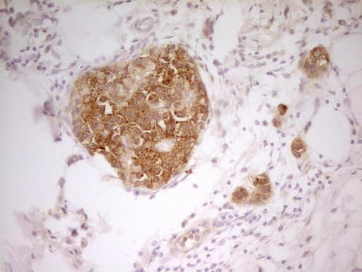 Monoclonal Mouse anti-Human PAK4 Antibody (clone OTI1C7, aa1-308, IHC, WB)
