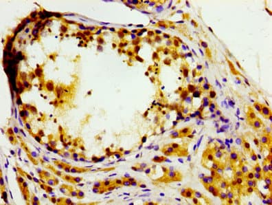 MASTL / GW Antibody