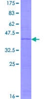 Human NDUFA11 / B14.7 Protein (Recombinant GST)