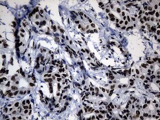 POLR2A / RNA polymerase II Antibody (aa1351-1614, clone OTI2B7)