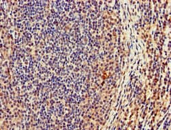 CASC1 Antibody