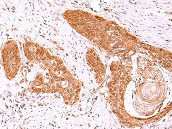 Polyclonal Rabbit anti-Human FDPS Antibody (IHC)