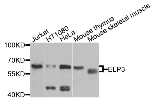 Polyclonal Rabbit anti-Human ELP3 Antibody (WB)