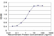 TNKS / Tankyrase Antibody (clone 1A2)