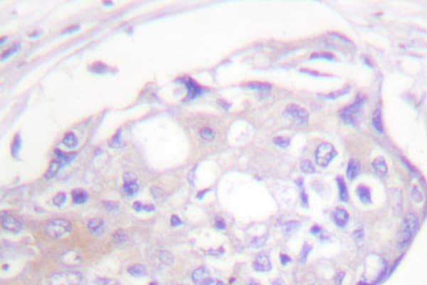 ADRBK1 / GRK2 Antibody (Thr23)