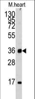 ULK3 Antibody (aa14-43)