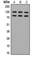 ADD1 / Adducin Alpha Antibody (phospho-Ser726/Ser713)