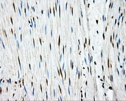 APP / Beta Amyloid Precursor Antibody (clone OTI7G9)