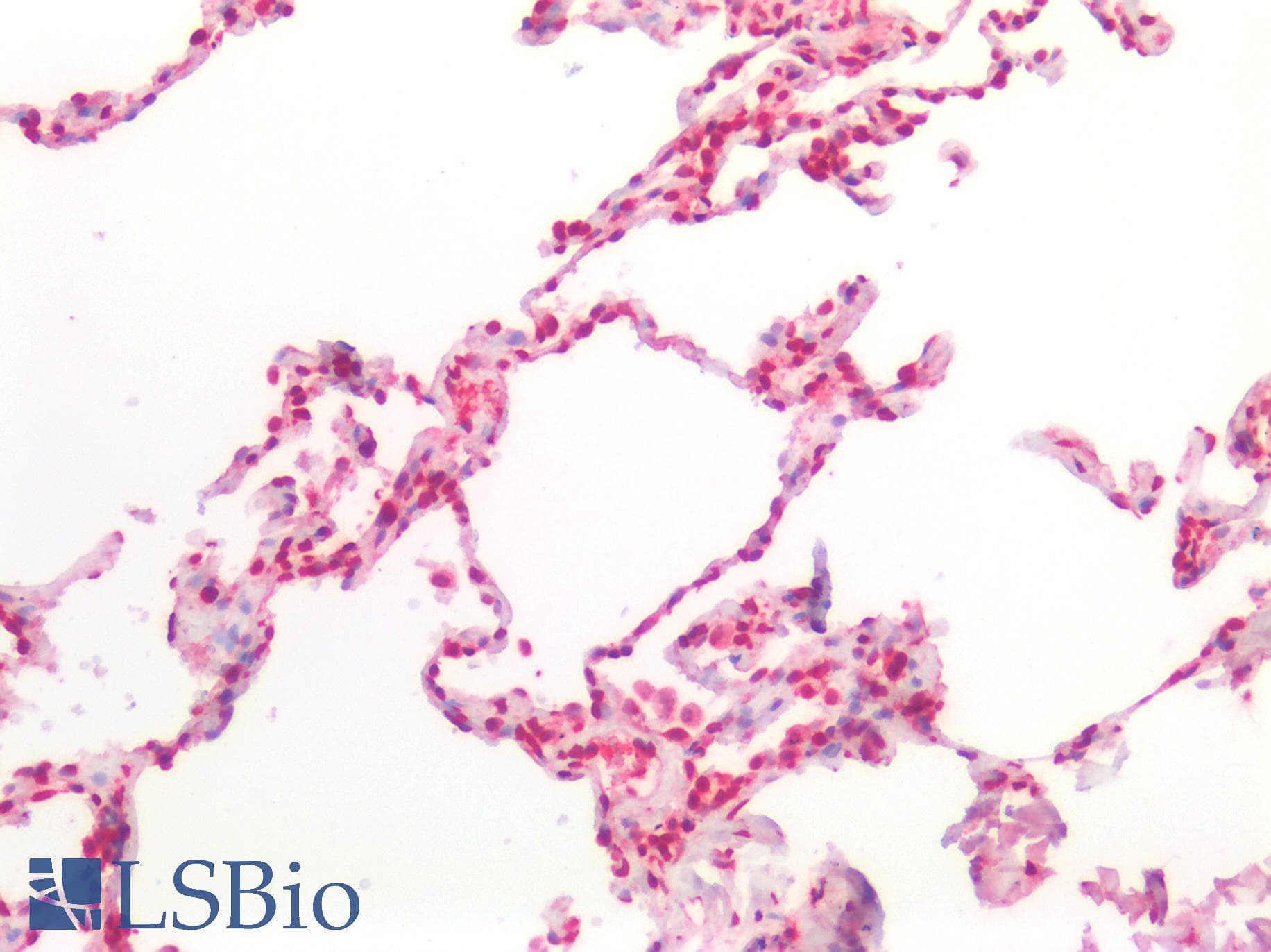 PathPlus™ BCL10 / BCL-10 Antibody (aa111-160)