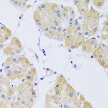 Polyclonal Rabbit anti-Human CLIP1 / CLIP-170 Antibody (IHC, WB)