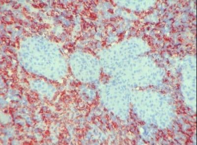 Macrophage Antibody (clone PM-2K)