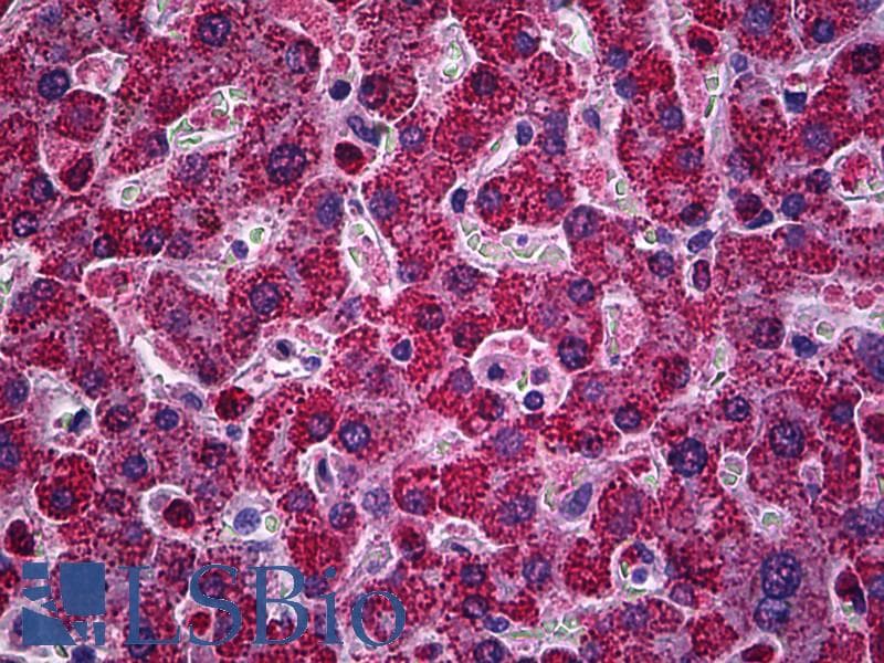 IHC-plus™ Monoclonal Mouse anti-Human PIM1 / Pim-1 Antibody (clone X1, IHC, IF)