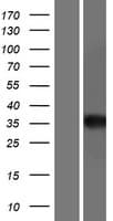 Human AGA / Aspartylglucosaminidase Protein (Over-Expression Lysate Myc-DDK (Flag))