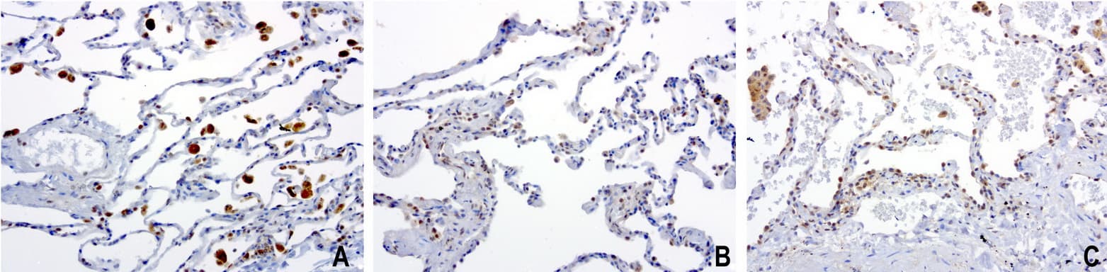 PSMA6 Antibody (clone UMAB102)