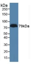 ADGRL3 / LPHN3 Antibody (aa1105-1447)