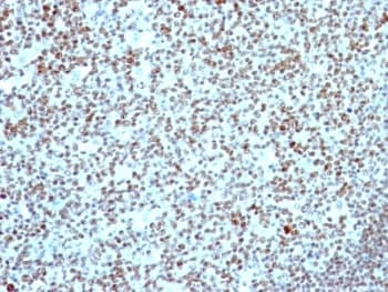 NCL / Nucleolin Antibody (clone NCL/902, Ready-to-Use)