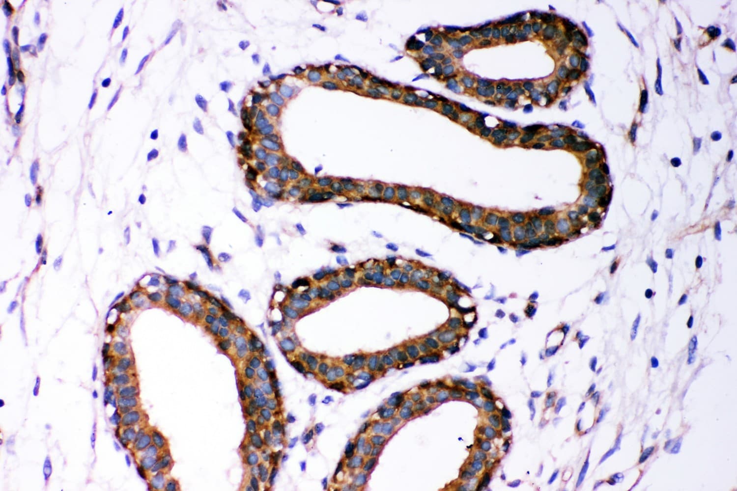 Polyclonal Rabbit anti-Human DICER1 / Dicer Antibody (aa1-195, IHC, WB)