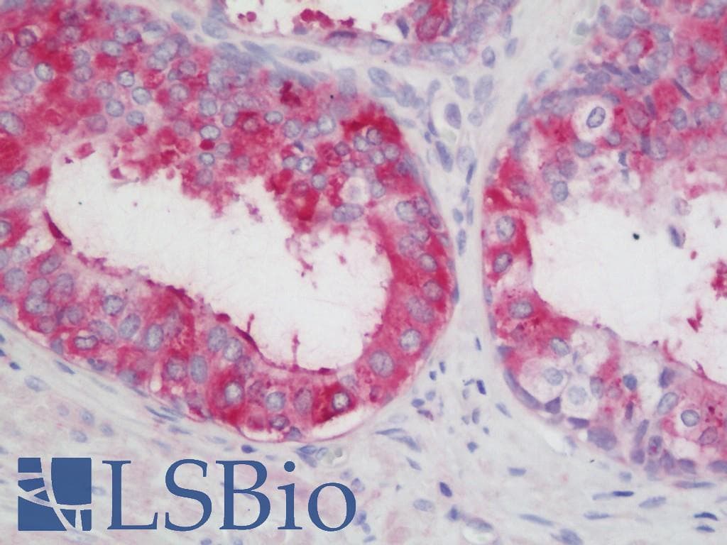 IHC-plus™ LOXL2 Antibody (aa454-742)