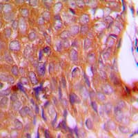 PathPlus™ CANX / Calnexin Antibody (C-Terminus)