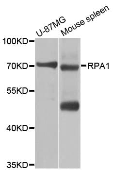 RPA70 / RPA1 Antibody