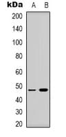 SSB / La Antibody (phospho-Ser366)