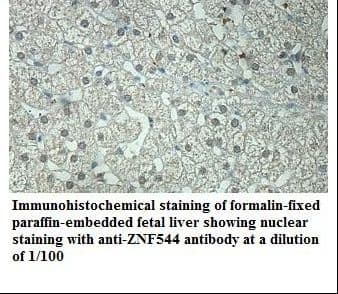 ZNF544 Antibody (aa326-622)