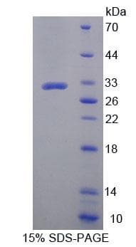 Human ZNF10 / KOX1 Protein (Recombinant His-T7)