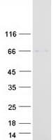 Human FCRL4 / IRTA1 / CD307d Protein (Recombinant Myc-DDK (Flag))