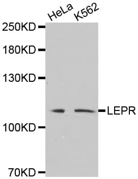 LEPR / Leptin Receptor Antibody