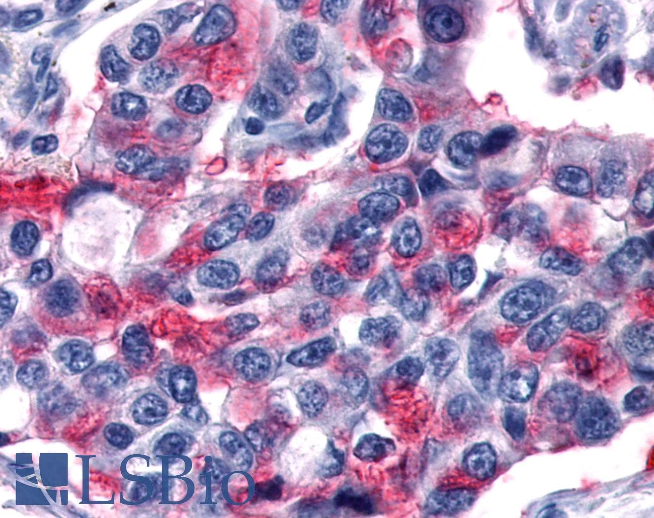 PathPlus™ Polyclonal Rabbit anti-Human GPR80 / GPR99 / OXGR1 Antibody (Extracellular Domain, IHC)
