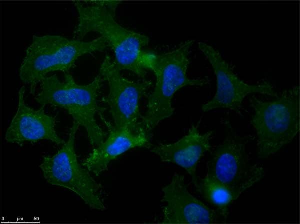 APP / Beta Amyloid Precursor Antibody
