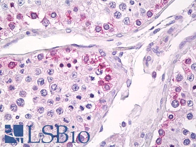 IHC-plus™ Polyclonal Rabbit anti-Human USP13 Antibody (aa500-550, IHC, WB)