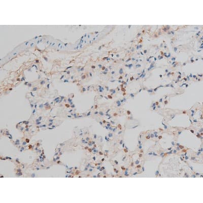 CREB1 / CREB Antibody (phospho-Ser142)