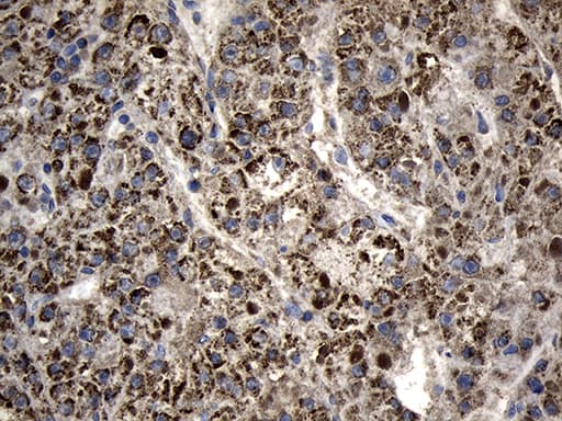 AGPAT9 / MAG1 Antibody (aa41-131, clone OTI6A3, Carrier-free)