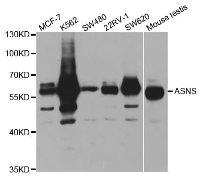 IHC-plus™ Polyclonal Rabbit anti-Human ASNS Antibody (IHC, IF, WB)