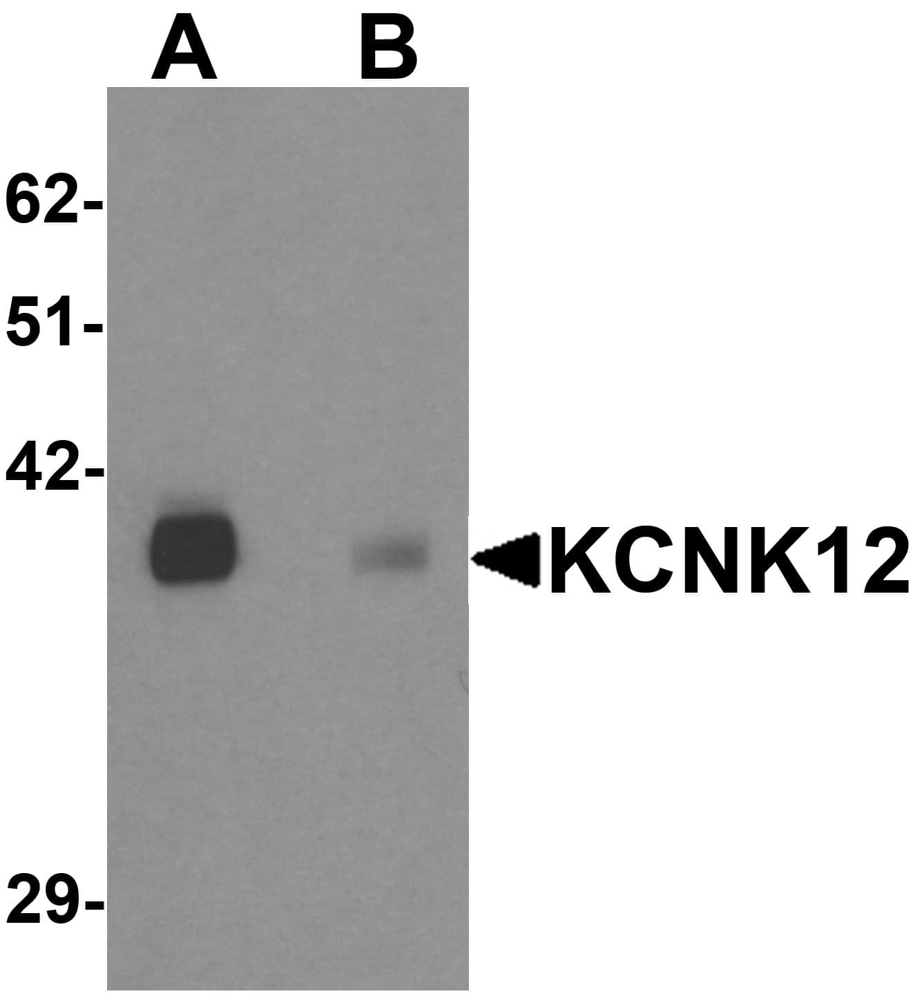 IHC-plus™ KCNK12 Antibody