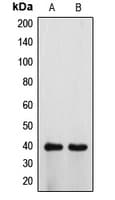 ATP6V0D1 Antibody (Internal)