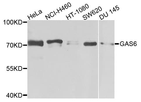 Polyclonal Rabbit anti-Human GAS6 Antibody (IHC, WB)