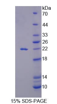 Pig IL18 Protein (Recombinant His-T7)