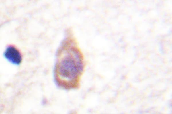 Polyclonal Rabbit anti-Human TGFBR2 Antibody (Glu246, IHC, WB)