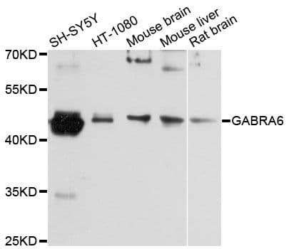 Polyclonal Rabbit anti-Human GABRA6 Antibody (WB)