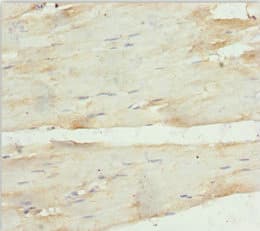CARP / ANKRD1 Antibody