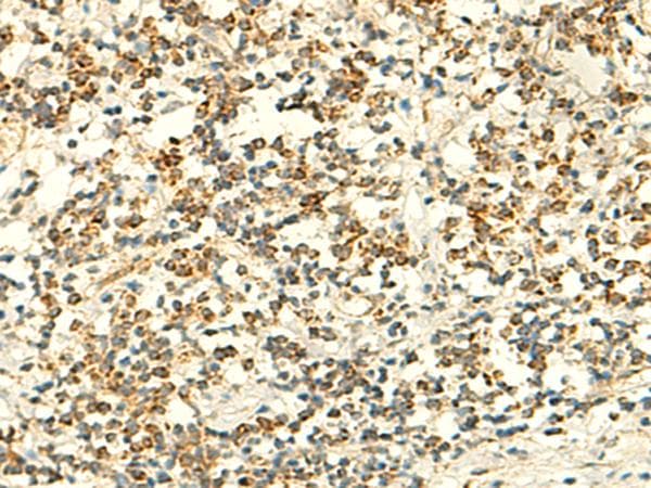 IFT27 / RABL4 Antibody