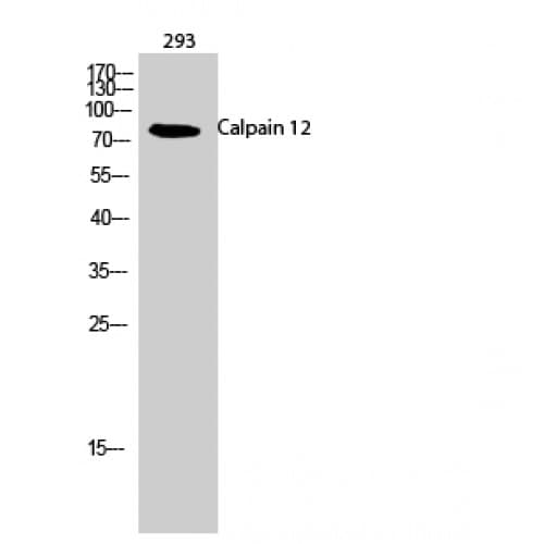 CAPN12 / Calpain 12 Antibody (190-270 aa, Internal)