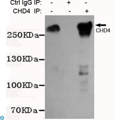 CHD4 Antibody