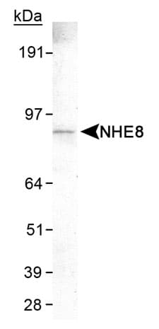SLC9A8 / NHE8 Antibody (C-Terminus, clone 7A11, DY550)