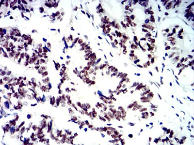 SMARCA1 / SWI Antibody (clone 2H7B8)